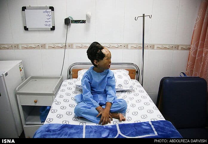 رعنا در اصفهان تحت عمل قرار گرفت