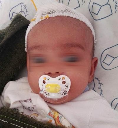  پدر شیشه ای نوزاد ۴ ماهه را ضربه مغزی کرد/ جدال "هستی" با مرگ